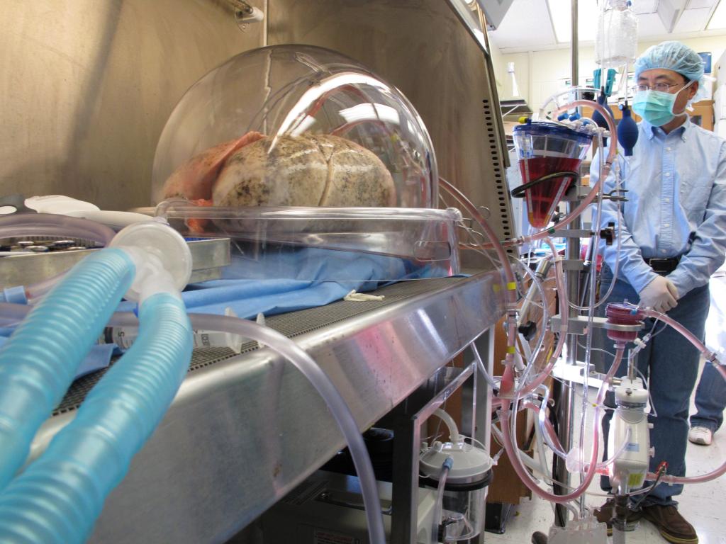 opération de greffe