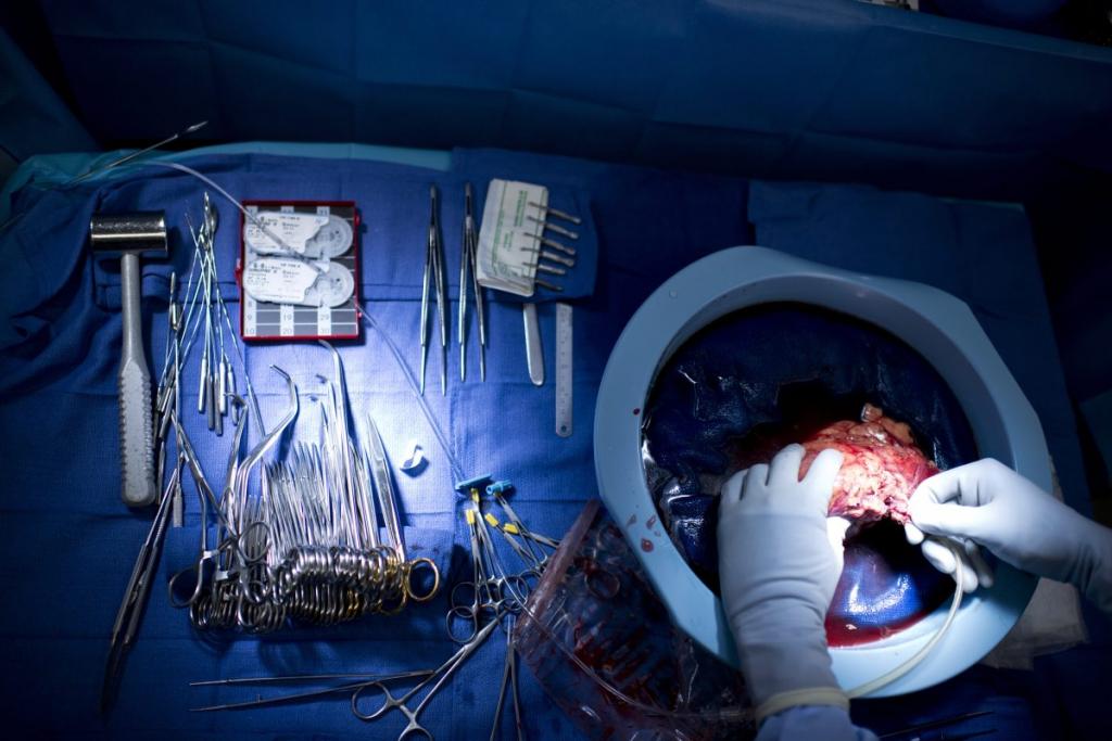 préparation d'une greffe d'organe