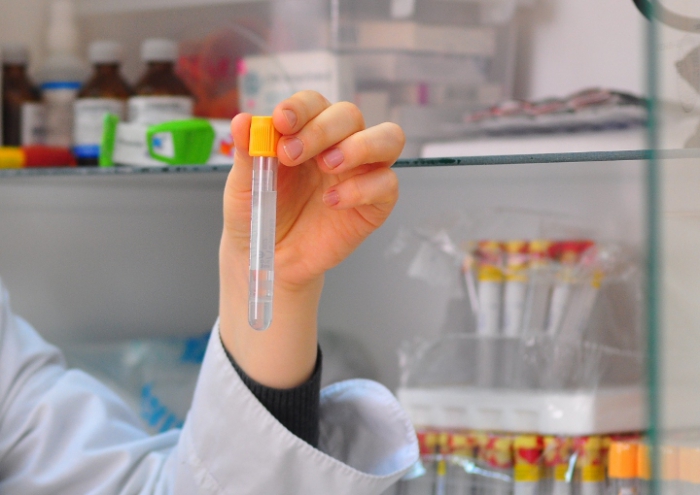 What does Rospotrebnadzor check in a cafe