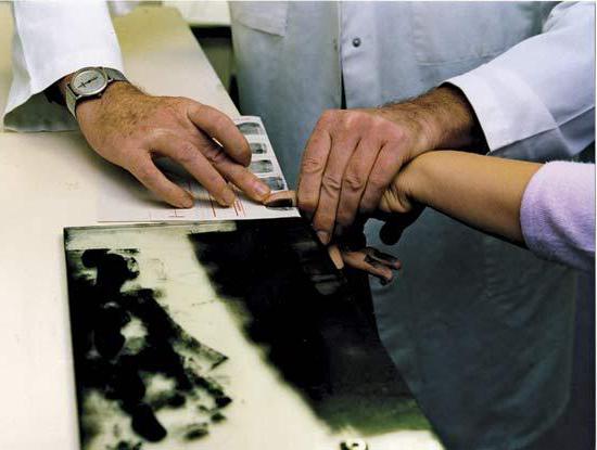 représentant légal d'un suspect mineur