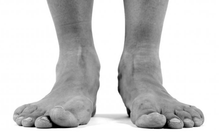 Platypodia 3 degrés prennent dans l'armée