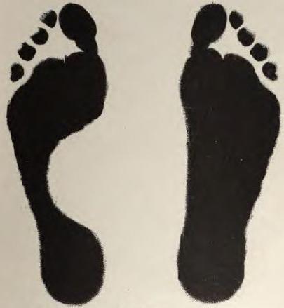 si elles prennent dans l'armée avec les pieds plats 3