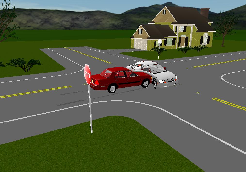 Interférence à droite lors de la reconstruction