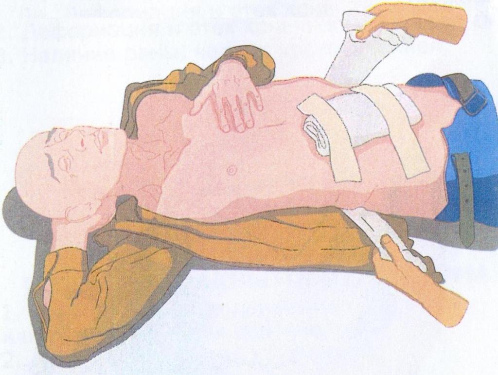 aide avec une blessure au couteau dans l'estomac